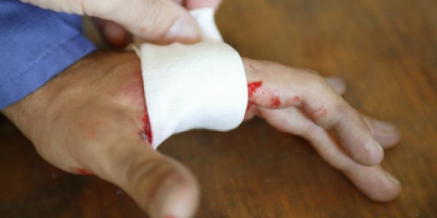 Fingertip Injuries and Amputation